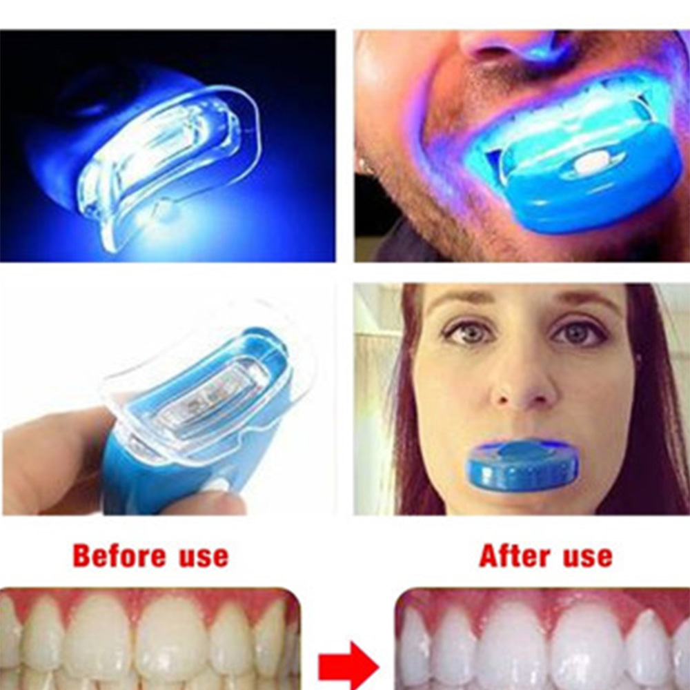Lampu Pemutih Gigi LED Lampu B - Teeth Whitening Laser Treatment ulasan dan harga