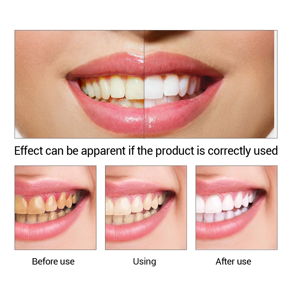 FTEENPLY Bubuk Esensi Pemutih  - Teeth Whitening Ai ulasan dan harga