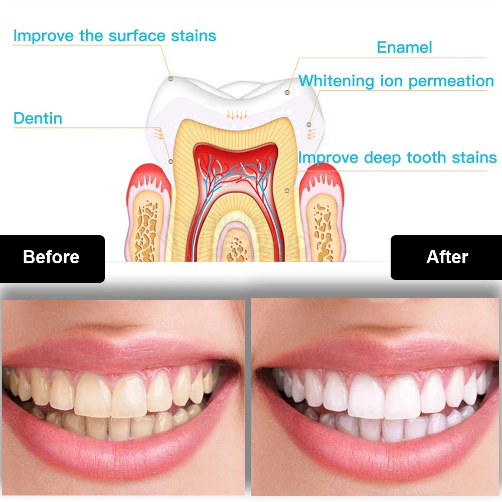 Kit pemutih gigi Mini 16 LED c - Teeth Whitening With Peroxide ulasan dan harga