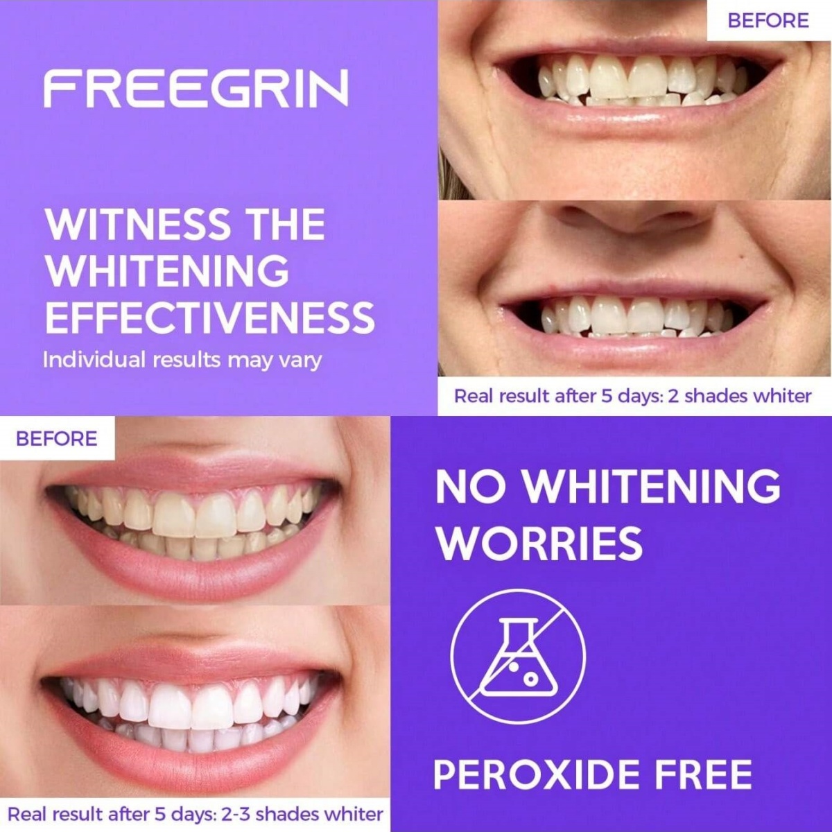 Stiker Gigi Pemutih Mewah 7/14 - Teeth Whitening With Peroxide ulasan dan harga